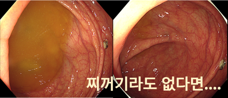 찌꺼기라도 없다면